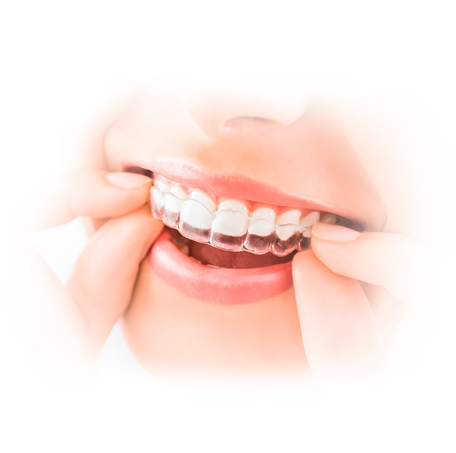 New Age Dental – Best Place for Invisalign® Clear Aligners in Philadelphia
