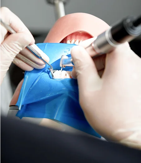 Close-up of dental treatment with rubber dam isolation