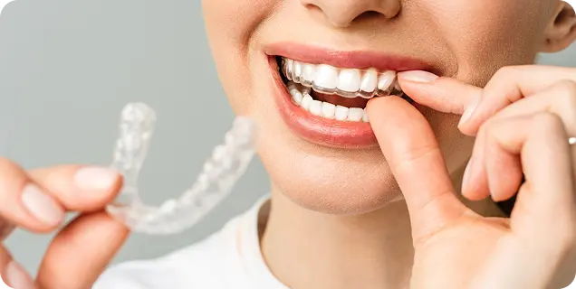 A woman inserting a clear dental aligner while holding a second aligner tray