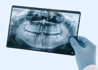 Dentist holding a panoramic dental X-ray