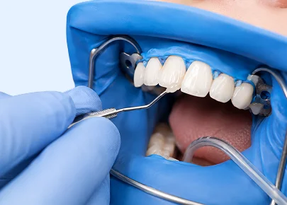 Dentist performing a cosmetic dental procedure