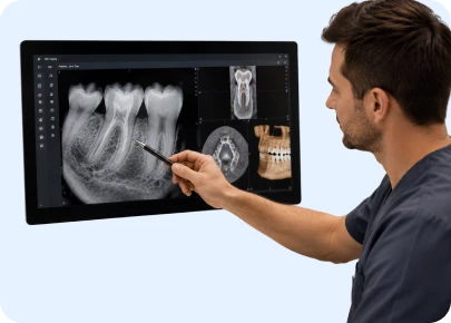 Dental professional pointing to tooth X-rays on a monitor