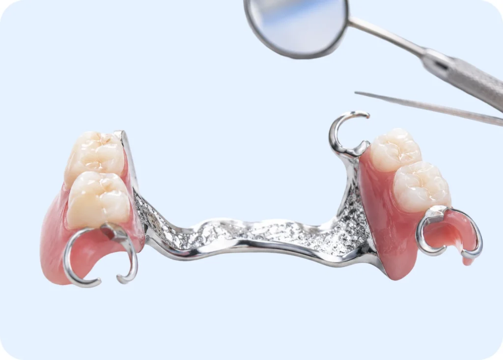 Metal-framed partial denture with attached teeth and clasps beside a dental mirror and probe