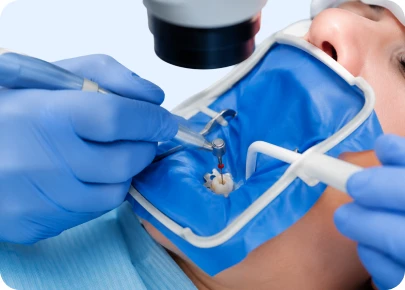 Gloved hands performing root canal treatment under a dental microscope